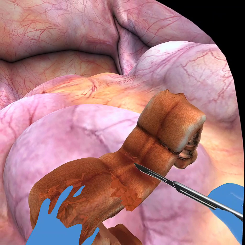 ネオ・フッキアン制約によるリアルタイム弾性体切断シミュレータの開発